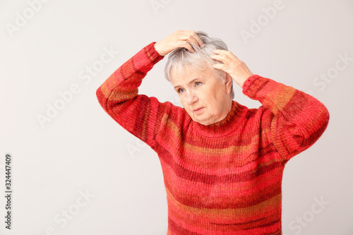 Senior woman with hair loss...
