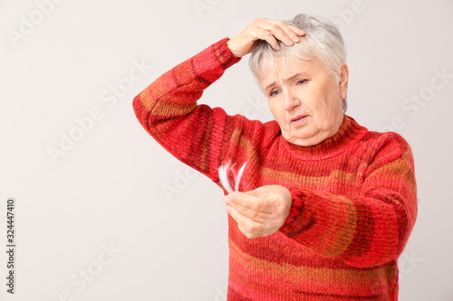 Senior woman with hair loss...