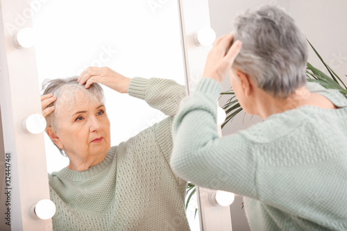 Senior woman with hair loss...