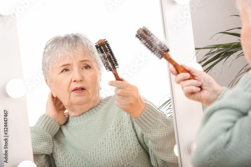Senior woman with hair loss...