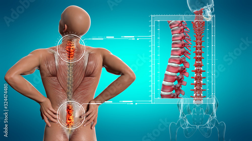 Anatomical vision back pain. Spine anatomy. 3D illustration.