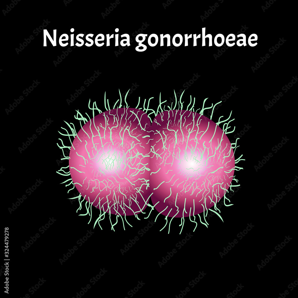 Gonococcus structure. Neisseria gonorrhoeae. Gonorrhea disease ...