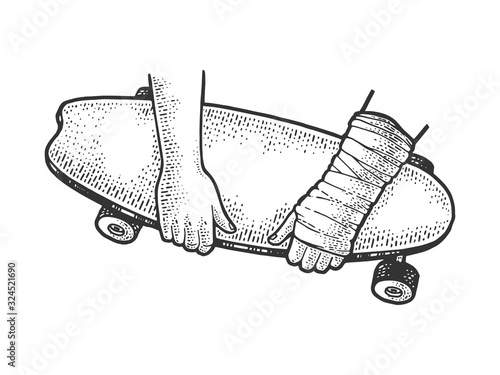 Skateboard and broken arm sketch engraving vector illustration. T-shirt apparel print design. Scratch board imitation. Black and white hand drawn image.