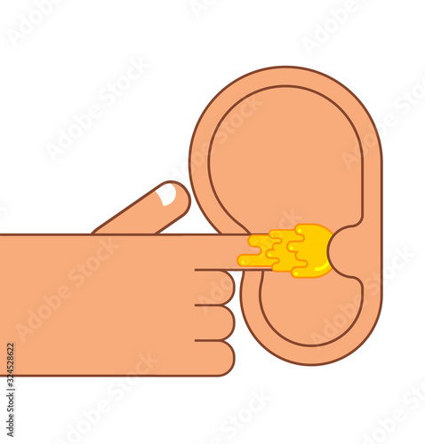 Finger in ear. Pick earwax with your finger. vector illustration