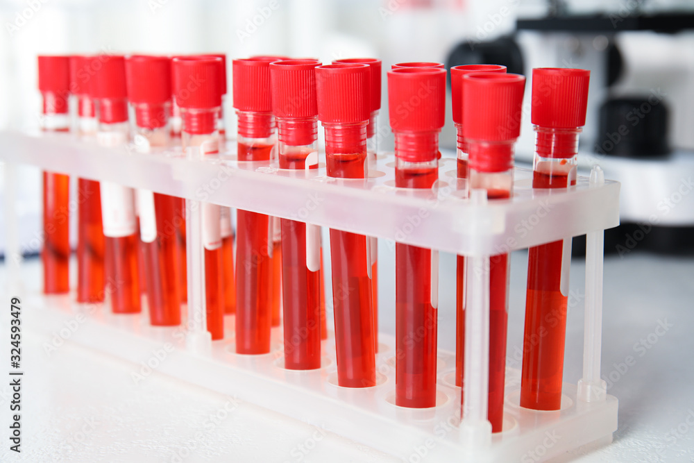 Test tubes with blood samples on table in laboratory, closeup. Virus research Test tubes with blood samples on table in laboratory, closeup. Virus research