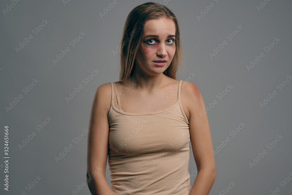 Naklejka premium Blonde girl with bruises on her face posing against gray studio background. Domestic violence, abuse. Depression, despair. Close-up, copy space.