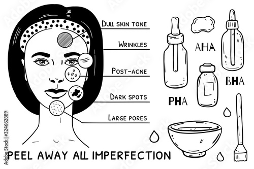 Illustration of skin problems that acid peeling solves.