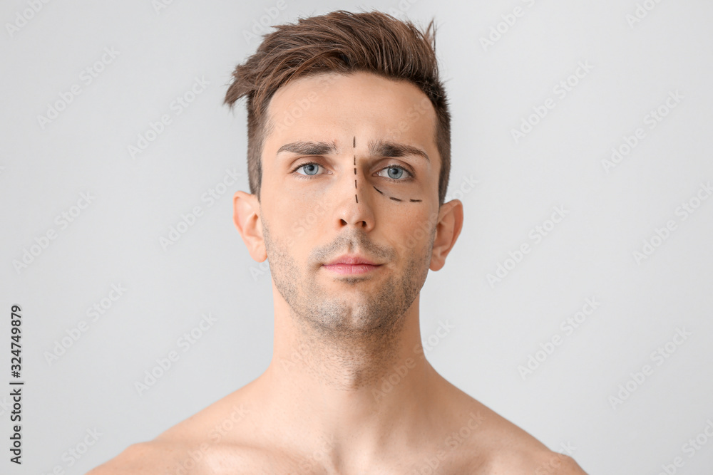 Naklejka premium Young man with marks on his face against light background. Concept of plastic surgery