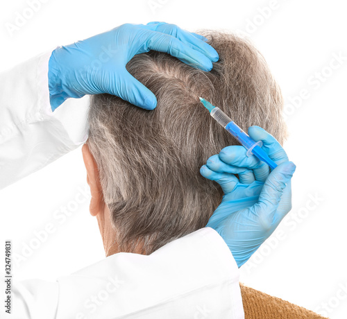 Senior woman with hair loss...