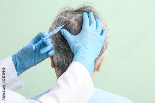Senior woman with hair loss...