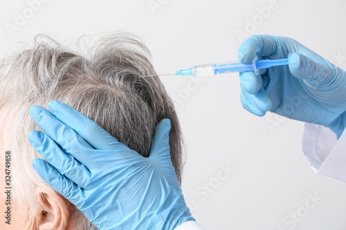 Senior woman with hair loss...