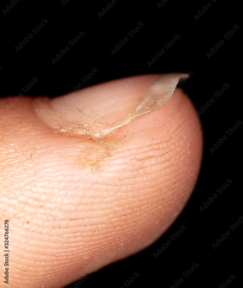 Nails with dirt on the finger Nails with dirt on the finger