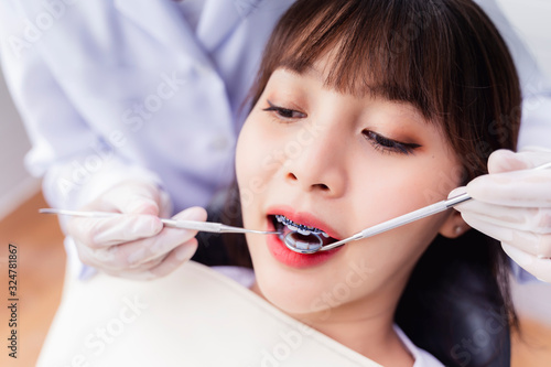 Asian Doctor Dentist examine female patient with braces in a dental office, wearing gloves standing in clinic check Close Up young braces Asian woman, Beautiful Asian girl smiles in dentistry.