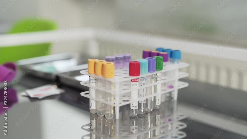close-up of test tubes with virus tests close-up of test tubes with virus tests