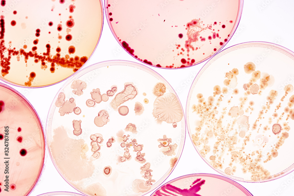 Growing Bacteria in Petri Dishes on agar gel Scientific experiment. Growing Bacteria in Petri Dishes on agar gel Scientific experiment.