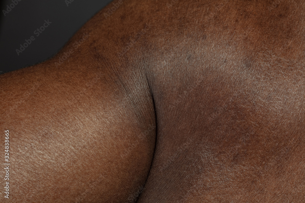 Hand. Detailed texture of human skin. Close up shot of young african-american male body. Skincare, bodycare, healthcare, hygiene and medicine concept. Looks beauty and well-kept. Dermatology. Hand. Detailed texture of human skin. Close up shot of young african-american male body. Skincare, bodycare, healthcare, hygiene and medicine concept. Looks beauty and well-kept. Dermatology.