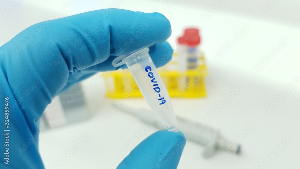 Coronavirus sample 