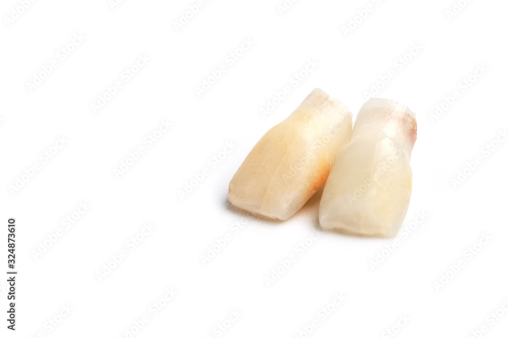Baby teeth on a white background. Loss of two lower teeth of the child at the stage of formation of the jaw. Baby teeth on a white background. Loss of two lower teeth of the child at the stage of formation of the jaw.