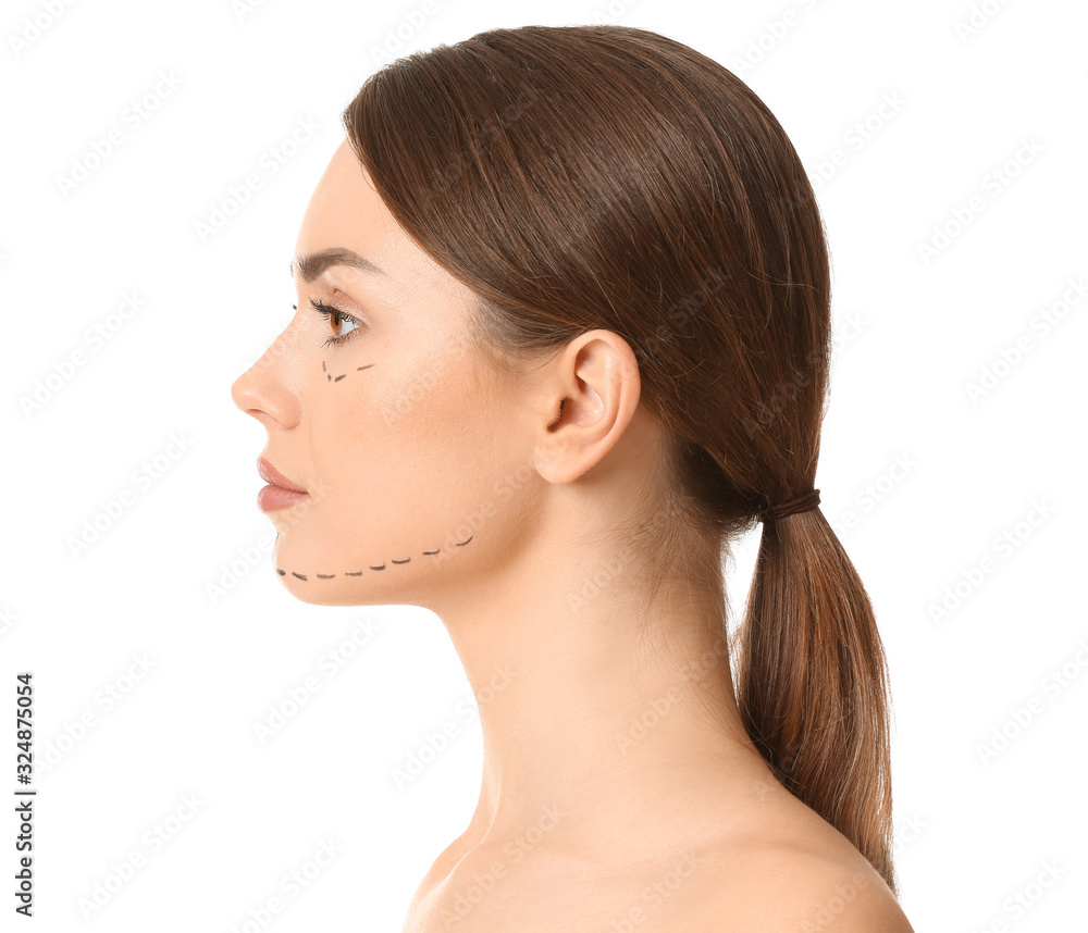Young woman with marks on her face against white background. Concept of plastic surgery Young woman with marks on her face against white background. Concept of plastic surgery