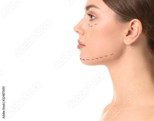 Young woman with marks on her face against white background. Concept of plastic surgery