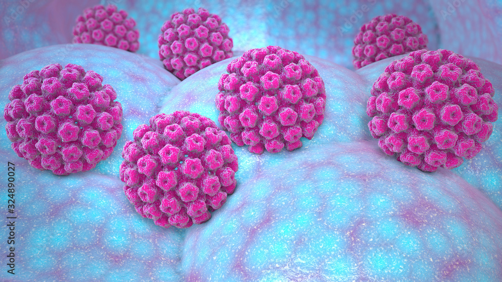 Human papillomavirus infection. Virus. HPV is the most common sexually