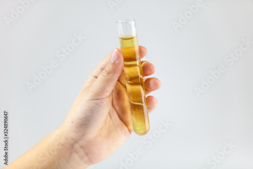 Hand holding test tube with liquid inside