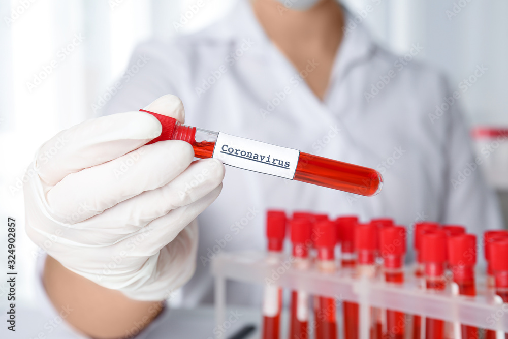 Scientist holding test tube with blood sample and label CORONA VIRUS in laboratory, closeup Scientist holding test tube with blood sample and label CORONA VIRUS in laboratory, closeup
