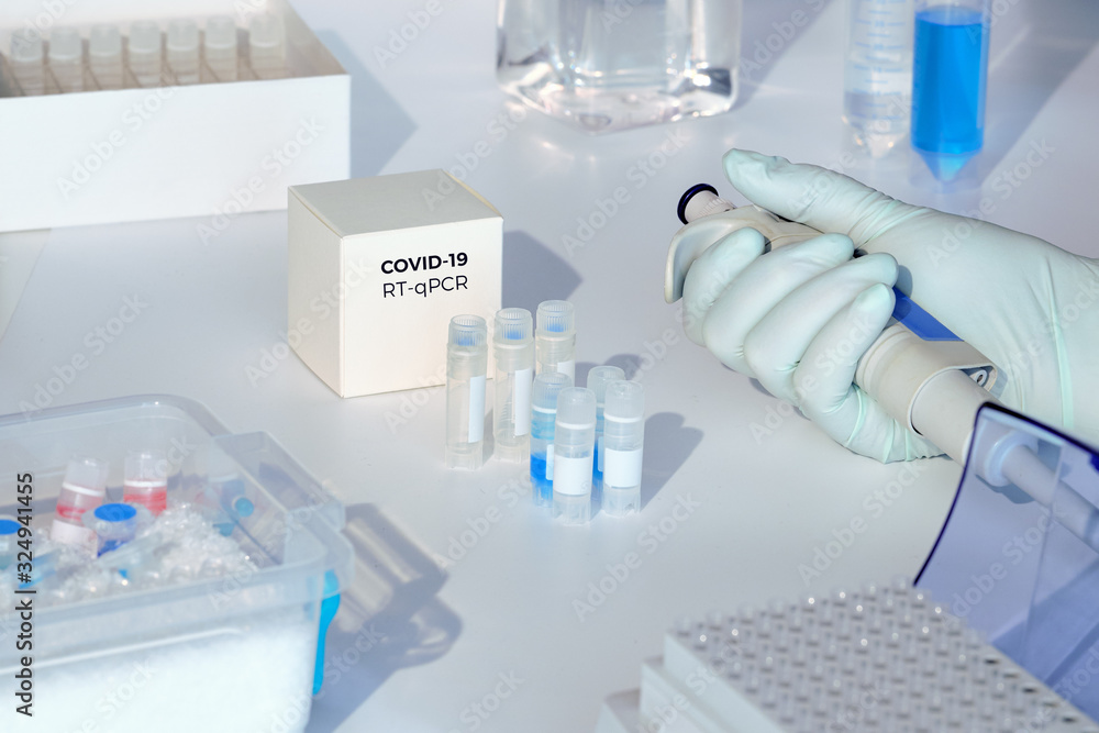 Test kit to detect novel COVID-19 coronavirus in patient samples. RT-PCR kit allows to convert viral Covid19 RNA to DNA and amplify specific sequence of 2019-nCov in viral gene coding spike. Test kit to detect novel COVID-19 coronavirus in patient samples. RT-PCR kit allows to convert viral Covid19 RNA to DNA and amplify specific sequence of 2019-nCov in viral gene coding spike.