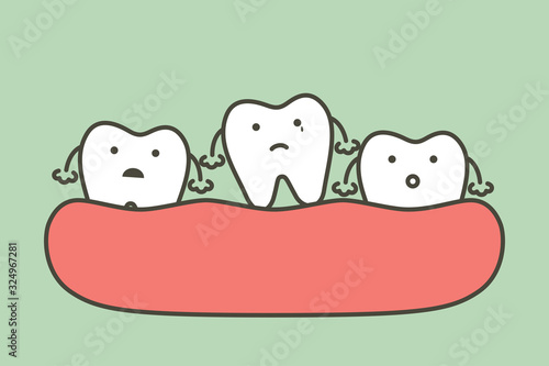loose tooth or missing teeth, tooth is fall out of the gum - dental cartoon vector flat style