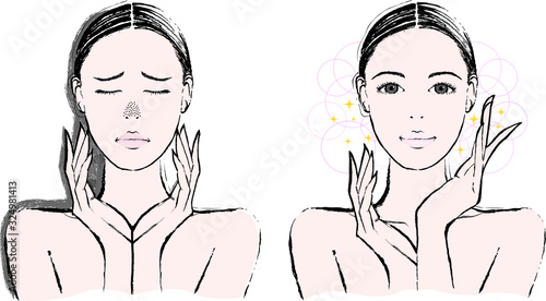 女性　鼻の黒ずみ　ビフォーアフター