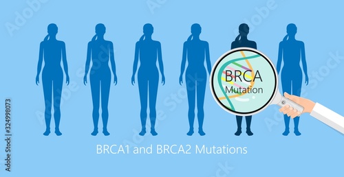 BRCA gene test for breast and ovarian cancer