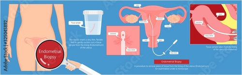 endometrial biopsy examination uterus procedure