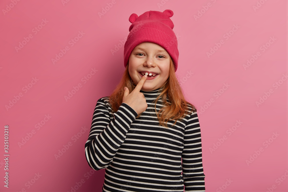Pretty small ginger girl shows her first adult two teeth, laughs and rejoices, expresses positive emotions, keeps mouth opened, prepares for oral checkup, dressed in striped sweater and pink hat Pretty small ginger girl shows her first adult two teeth, laughs and rejoices, expresses positive emotions, keeps mouth opened, prepares for oral checkup, dressed in striped sweater and pink hat