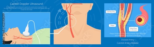 Coronary artery disease CAD diagnosis treatment