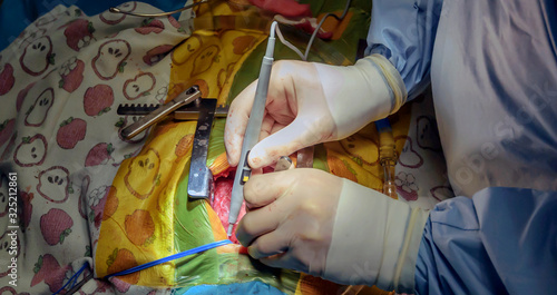 Ross's operation is the surgical treatment of aortic valve defects.