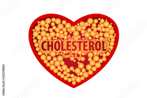 Cholesterol in artery, health risk , vector design