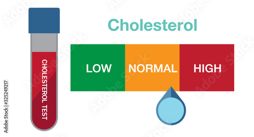 cholesterol test, Cholesterol in artery, health risk , vector design