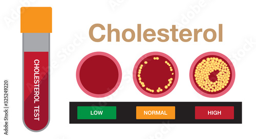 cholesterol test, Cholesterol in artery, health risk , vector design
