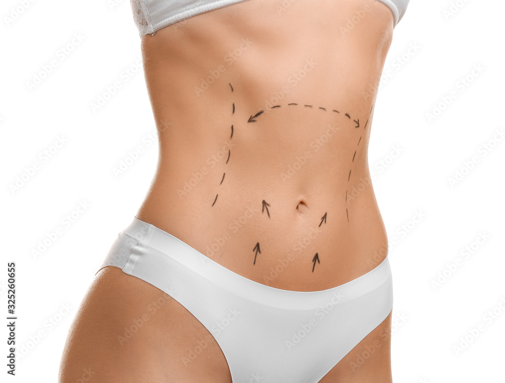 Young woman with marks on her belly against white background. Concept of plastic surgery - obrazy, fototapety, plakaty 