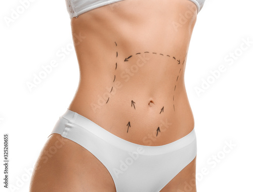 Young woman with marks on h...