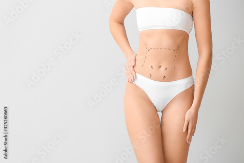 Young woman with marks on her belly against light background. Concept of plastic surgery © Pixel-Shot
