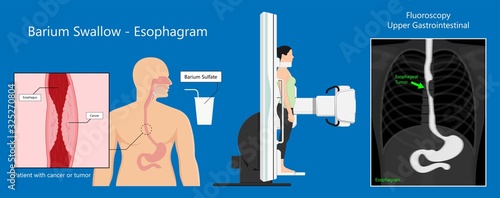 Intravenous pyelogram IVP exam diagnose treat ionizing symptom