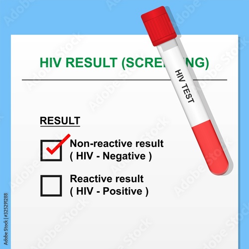 HIV Test Result with Vacutainer Contain Lab Diagnose Sexual Transmission
