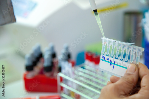 Crossmatching, Compatibility testing between patient blood and donor blood