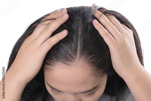 Young Asian women worry about problem hair loss,head bald,dandruff.hair loss problem and Hair treatment concept