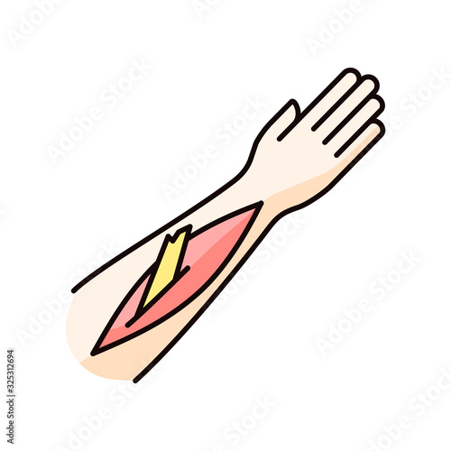 Open bone fracture RGB color icon. Bone sticking out of human arm. Badly injured hand. Wounded limb. Accident. Emergency. Healthcare. Isolated vector illustration