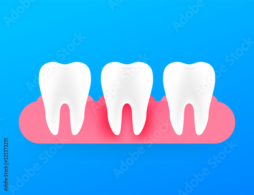 Gum disease, periodontitis. Healthy white tooth. Vector stock illustration.