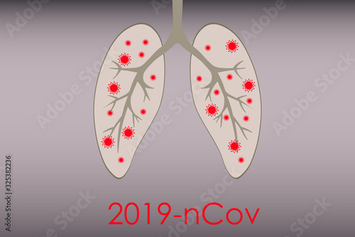 Medical genetics bacteriological Microorganism background. Wuhan Chinese Coronavirus 2019-nCoV. Pneumonia. Bacteria Biology Organisms. Virus infection epidemic sick. Health background.  Sick lungs.