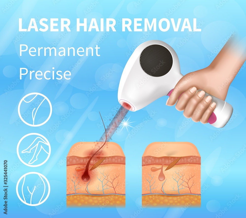 Hair Laser Removal, Permanent Precise Square Banner, Female Hand