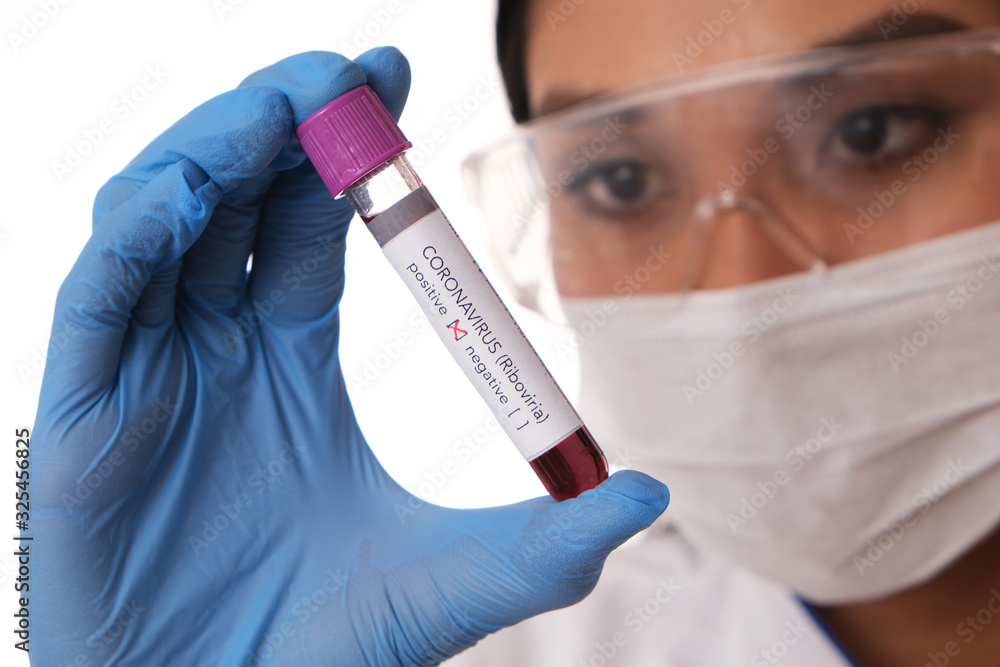Laboratory diagnostician in a goggles and gloves holding a blood sample. Coronavirus epidemy. Laboratory diagnostician in a goggles and gloves holding a blood sample. Coronavirus epidemy.
